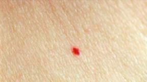 Red spots on the body: what to do if they itch, flake and itch