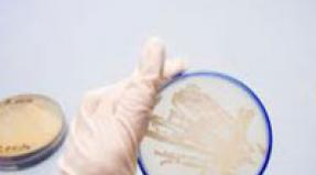 انتهاك البكتيريا المهبلية: الأسباب والأعراض