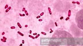 Escherichia coli (E. coli).  Microbiologie avec technologie de recherche microbiologique - Escherichia coli Microbiologie
