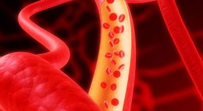 علامات أمراض الأوعية الدموية الدماغية وطرق علاجها
