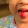 Mon enfant s'est mordu la langue, que dois-je faire ?
