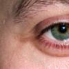 Comment enlever les poches sous les yeux ?