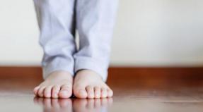 Treatment of flat feet in children at home